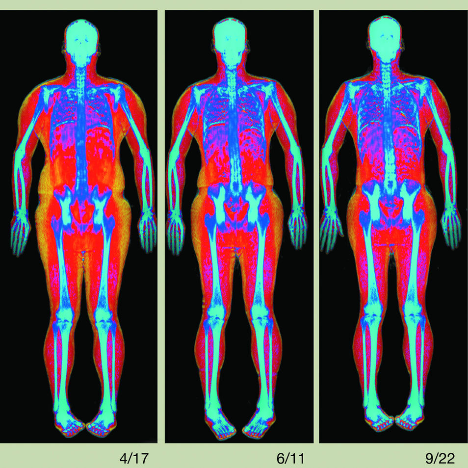 Body Scan